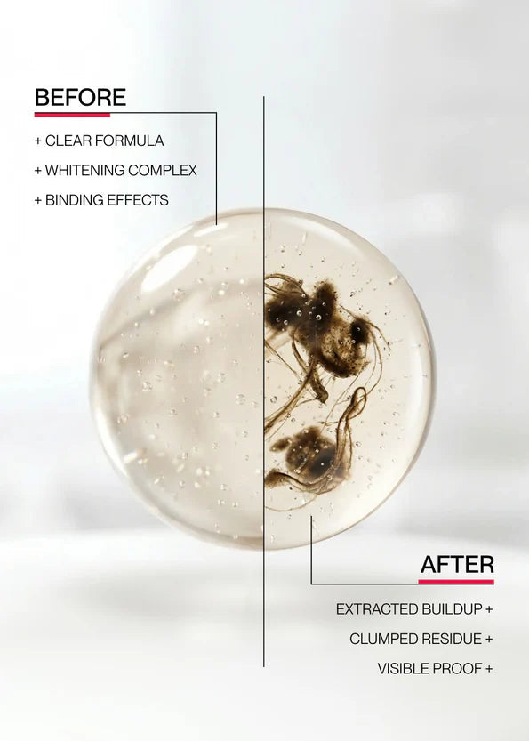 ID Stain Whitening Mouthwash