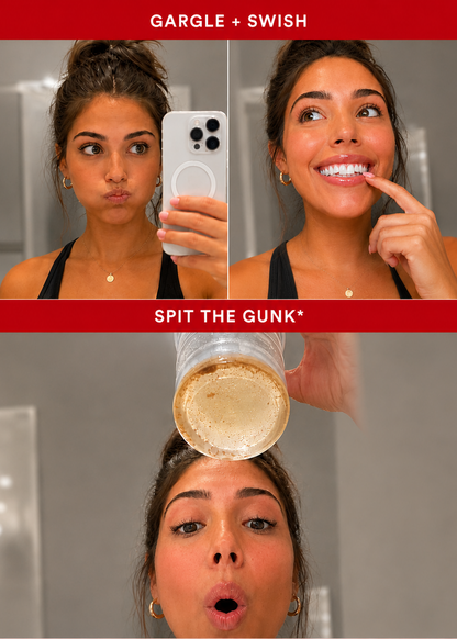 ID Stain Whitening Mouthwash