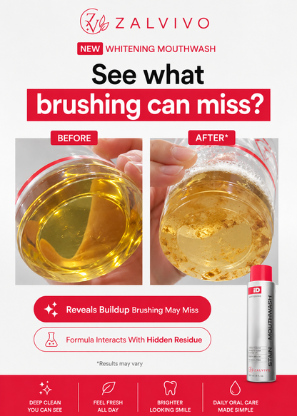 ID Stain Whitening Mouthwash